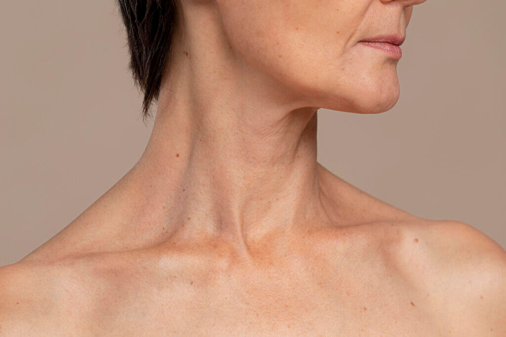 Imagen del cuello de una señora mayor.