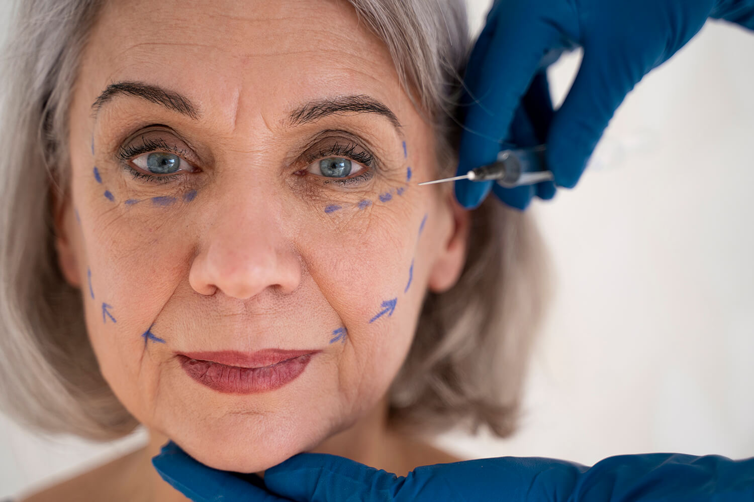 Manos con guantes azules pinchando la cara de una señora mayor. La señora tienen pintada en el contorno de sus ojeras, una linea discontinua azul.